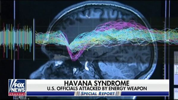 Intel Agencies No Sign Adversaries Behind Havana Syndrome Article