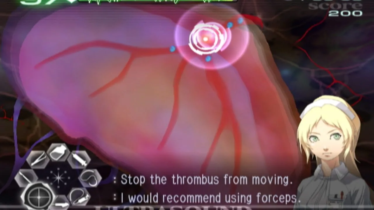 Trauma Center: Second Opinion gameplay on Wii