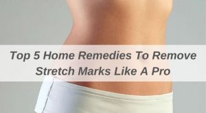 Home Remedies To Remove Stretch Marks