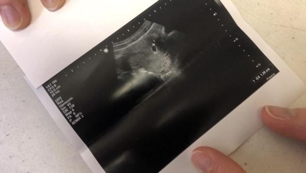 Parental consent Img