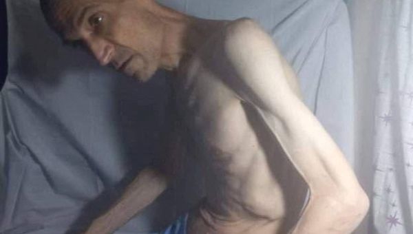 Images of Emaciated Iranian Prisoner on Hunger Strike Prompt Outrage – KAYHAN LIFE