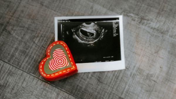 South Carolina Supreme Court Upholds Heartbeat Law – Marriage & Family – Home & Family – News – Catholic Online