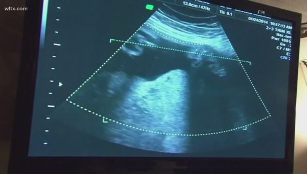 SC Supreme Court upholds state’s ‘fetal heartbeat’ abortion ban