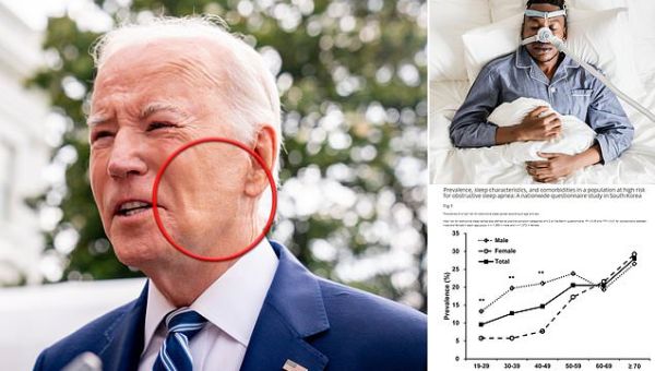What is sleep apnea? The disorder suffered by Joe Biden explained