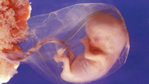 Supreme Court Will Hear Case to Ban Mail-Order Abortions, Save Babies From Dangerous Abortion Pills – LifeNews.com