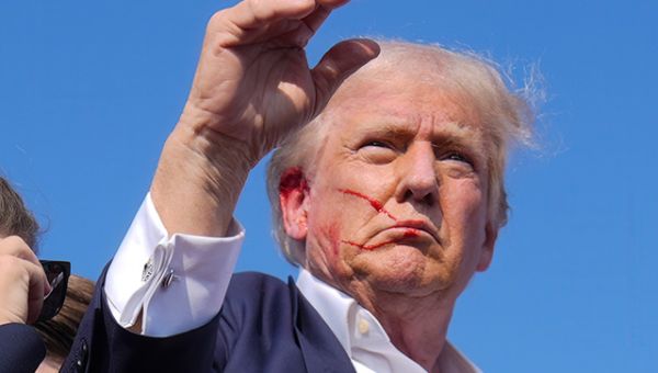 Report: Attempted Assassination Bullet ‘Tore off Small Piece’ of Trump’s Ear