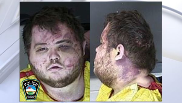 Colorado gay club shooting suspect, visibly injured by patrons, held without bail
