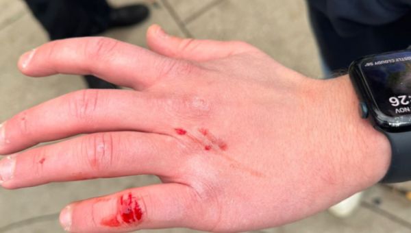 Jewish Students ‘Brutally’ Assaulted at DePaul University in Chicago