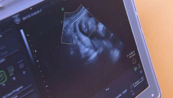 'We have prevailed': Governor praises SC Supreme Court 6-week abortion ban ruling