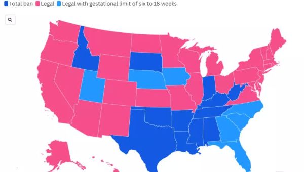 Map shows states with strictest abortion laws after SC Supreme Court ruling