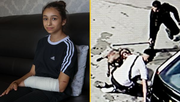 Girl, 11, attacked by XL bully in Birmingham says the dog should be put down and its owner jailed