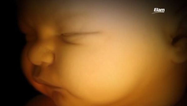 Iowa Supreme Court Upholding Heartbeat Law is a Huge Pro-Life Victory - LifeNews.com