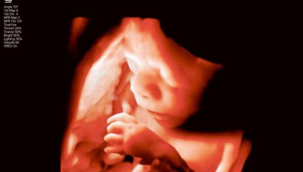 Wyoming to Appeal Judge’s Decision Striking Abortion Ban, Will Fight in Court to Save Babies – LifeNews.com