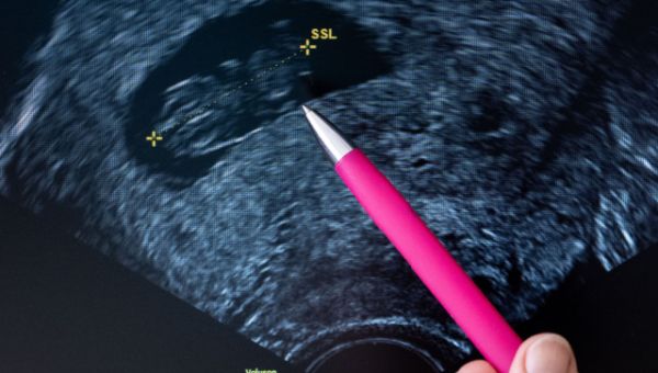 Georgia Judge Tosses Abortion Law; Attorney General Appeals to State Supreme Court