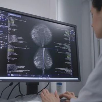 Breast cancer: Why do so many women still avoid mammograms in India?