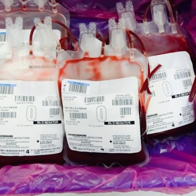 $88b bloodbath shows Trump is not the only problem for Aussie pharma giant