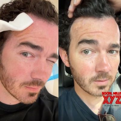 Kevin Jonas reveals he has cancer, urges people to make sure they get moles checked