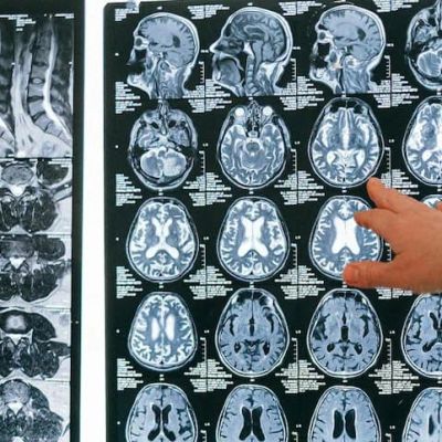 How ‘brain-eating amoeba’ is claiming lives in Kerala – ‘Death happens within …’