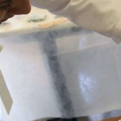 Preventable cervical cancer kills a woman every two minutes: UN