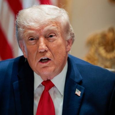 Trump in excellent health with leg swelling, hand bruising, doctor says