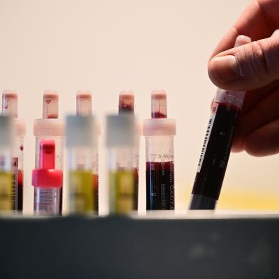 HIV cases rising in Lithuania, driven by infections among foreign nationals