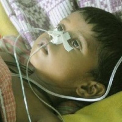 Californian Study Confirms HPMV is Neurotropic and Causes CNS Issues Like Febrile Seizures and Fatal Encephalitis in Children