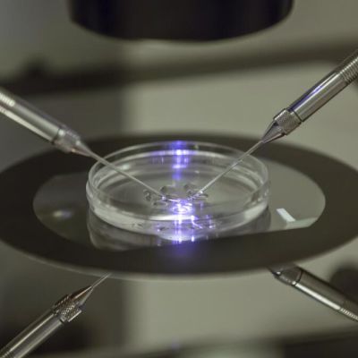 Editorial: A right to IVF or abortion will never be protected if fetuses and embryos are declared people