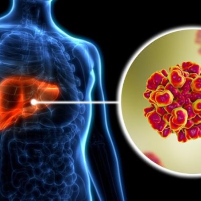 How to protect yourself from hepatitis