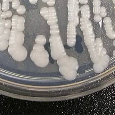 Deadly, drug-resistant fungus CDC calls ‘urgent threat’ is spreading in hospitals