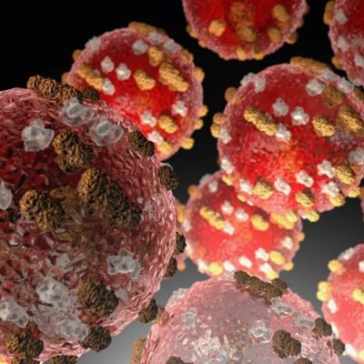 Ohio reports first measles case of 2025 in Ashtabula County