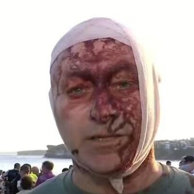 Bondi survivor tells Australian commission he was accused of being AI ‘crisis actor’