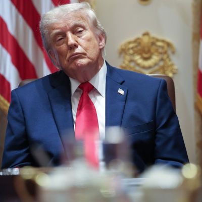 Reason behind Donald Trump’s bruised hands revealed in new health test
