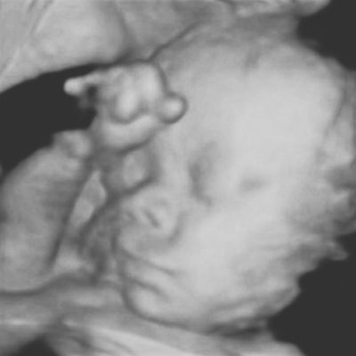 WATCH: Crowd Laughs As Dem Governor Allows Abortion Until Birth