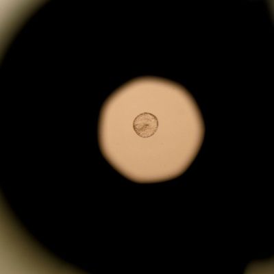 At meeting on guardrails for gene editing of human embryos, some call for a dead end