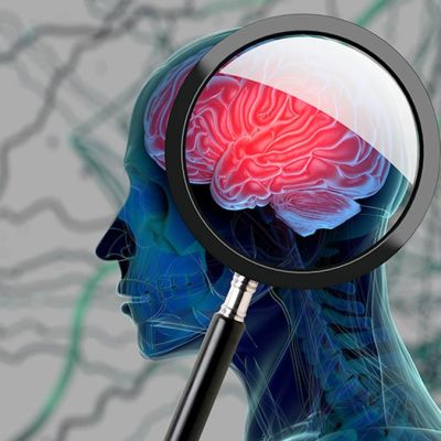 Alzheimer’s disease is not “old age.” Early diagnosis is essential for treatment and management – ExBulletin