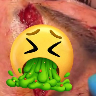 NSFW! UFC Doctor Releases Video Of Irene Aldana’s Horrific Face-Gash After UFC 306