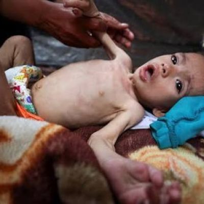 UNRWA: 508 children acutely malnourished in Gaza