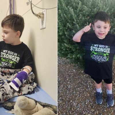 Duchenne muscular dystrophy gene therapy provides hope, concern