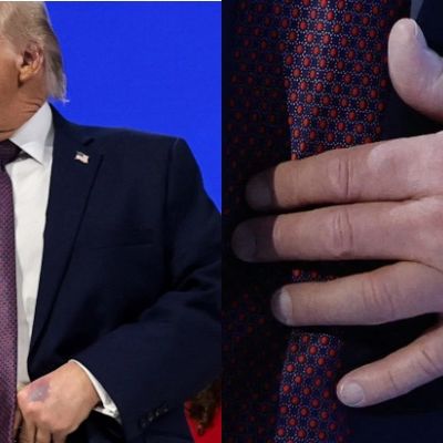 Trump addresses bruised hand at Davos
