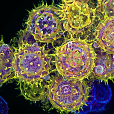 Cleveland, Akron among Ohio cities with favorable 2025 allergy forecast