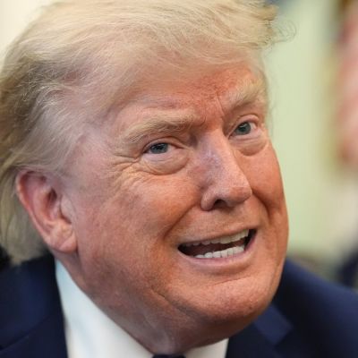 Donald Trump’s ‘scalp reduction’ memes go viral; Internet compares his hair to cat, caterpillar ‘scurrying away’