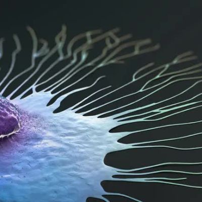 Roche pill delays tumor progression in closely watched breast cancer study