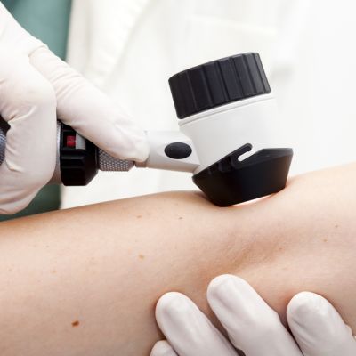 newsGP – ‘Eye-watering’ skin cancer burden laid bare