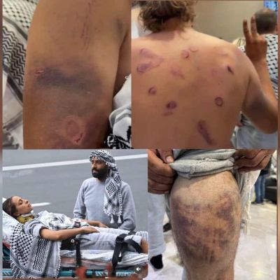 Activists describe physical torture after Israel intercepts Gaza flotilla