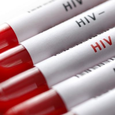 Around 40m infected by HIV/AIDS globally