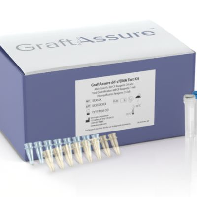 Oncocyte Reports Successful 2024; Sets Stage for 2025 Catalysts