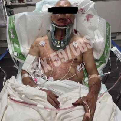 Truck Driver Allegedly Assaulted by Mark Sanchez Is Seen Lying Bloodied and Bruised in Hospital After Stabbing Ex-NFL Quarterback