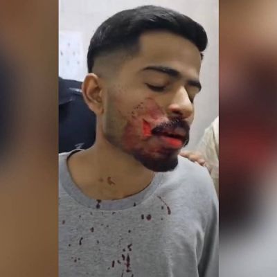 Four Indian medical students stabbed inside their hostel premises in Russia; one critical