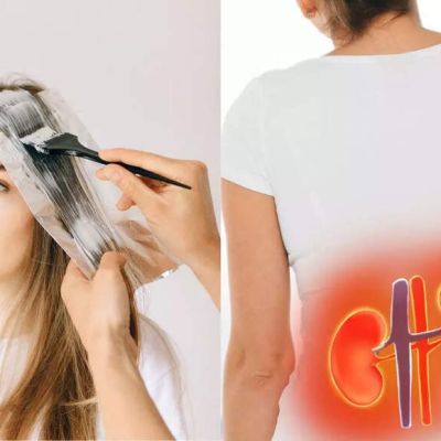 How hair dye can damage your kidneys: Know the health risks and safety tips | – The Times of India