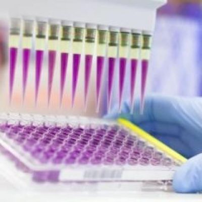 A blood test that screens for multiple cancers at once promises to boost early detection